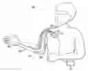 Fig. 01 - Neural prosthesis system and method of control