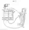 Fig. 03 - Neural prosthesis system and method of control