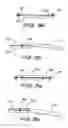 Fig. 08 - Fixation system for an implantable medical device