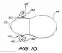 Fig. 09 - Fixation system for an implantable medical device