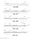 Fig. 18 - Implantable devices with thin film feedthrough