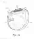 Fig. 27 - Implantable devices with thin film feedthrough