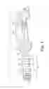 Fig. 06 - Implantable medical device with locking datum arrangement between DF4/IS4 assembly and header