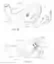 Fig. 10 - Weighted iron set