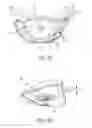 Fig. 05 - Golf club