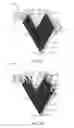 Fig. 07 - Sound absorbing rebounding device