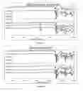 Fig. 10 - Method for preparing an asymmetric membrane