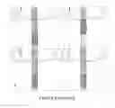 Fig. 22 - Integrated nucleic acid analysis