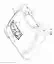 Fig. 07 - Paint sprayer attachment