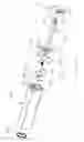 Fig. 09 - Handheld misting device with pressure-relieving handle