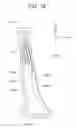 Fig. 11 - MANUFACTURING METHOD OF THICKNESS-VARIED METAL PLATE, MANUFACTURING METHOD OF PRESSED PART, AND PROCESSING MACHINE