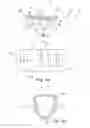 Fig. 03 - Method of manufacturing a cylindrical housing of an exhaust gas treatment unit and method of manufacturing an exhaust gas treatment unit for vehicles