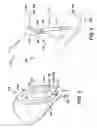 Fig. 04 - SELF-BREAKING SUPPORT FOR ADDITIVE MANUFACTURING