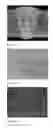 Fig. 07 - High Strength Weld Metal for Demanding Structural Applications