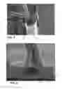 Fig. 04 - SPACER PRODUCT