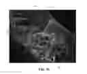 Fig. 07 - SPACER PRODUCT