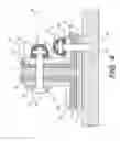 Fig. 05 - Repair including a chamfered bracket and a chamfered bracket component for reinforcing a damaged structural element made from composite materials