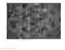 Fig. 10 - Hydraulically treated nonwoven fabrics and method of making the same