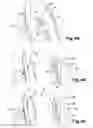 Fig. 05 - Motor vehicle comprising running gear attachment guide means