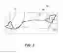 Fig. 04 - Determining an occupancy status of a vehicle seat