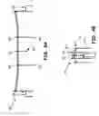 Fig. 04 - ZIP TRACK SYSTEM