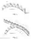 Fig. 02 - Multi-sprocket assembly for a bicycle