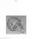 Fig. 11 - Safety cap spout