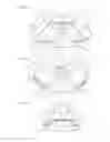 Fig. 02 - Bioimplant package and bioimplant packaging method