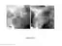 Fig. 14 - PROCESS FOR PREPARING SMALL SIZE LAYERED DOUBLE HYDROXIDE PARTICLES