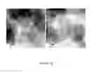 Fig. 15 - PROCESS FOR PREPARING SMALL SIZE LAYERED DOUBLE HYDROXIDE PARTICLES