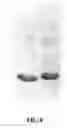 Fig. 06 - Bi-targeted Mutain MuR6S4TR of TRAIL and Preparation Method and Application Thereof