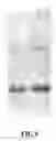 Fig. 06 - Bi-targeted Mutain MuR5S4TR of TRAIL and Preparation Method and Application Thereof