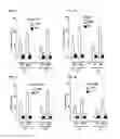 Fig. 04 - Method of Increasing GIPCR Signalization in the Cells of a Scoliotic Subject