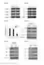 Fig. 13 - Method of Increasing GIPCR Signalization in the Cells of a Scoliotic Subject