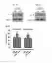 Fig. 16 - Method of Increasing GIPCR Signalization in the Cells of a Scoliotic Subject