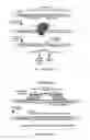 Fig. 12 - Genetically Modified IPS Cells That Carry a Marker to Report Expression of Neurogenin3, TPH2, FOXO1 and/or Insulin Genes