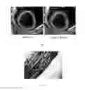 Fig. 03 - Continuously bioprinted multilayer tissue structure