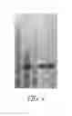 Fig. 06 - ACETOLACTATE DECARBOXYLASE