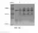 Fig. 12 - Long Adapter Single Stranded Oligonucleotide (LASSO) Probes to Capture and Clone Complex Libraries