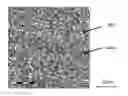 Fig. 01 - High strength steel and production method