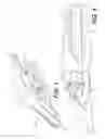 Fig. 04 - Implement tip assembly having tip with wear indicator