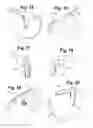 Fig. 09 - Hydrant shear valve and method
