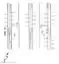 Fig. 33 - Wellbore plug isolation system and method