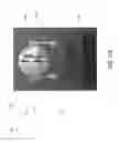 Fig. 22 - Sensor device, systems, and methods for identifying leaks in a fluid conduit