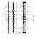 Fig. 47 - Sensor device, systems, and methods for identifying leaks in a fluid conduit