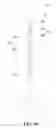 Fig. 07 - Fully automatic telescopic rod