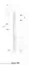 Fig. 08 - Fully automatic telescopic rod