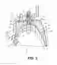 Fig. 04 - Channel between headlight chambers