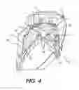 Fig. 05 - Channel between headlight chambers