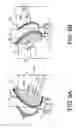 Fig. 09 - Magnetic Device for Holding a Firearm